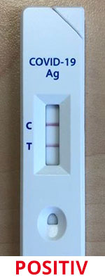 Antigen-Schnelltest